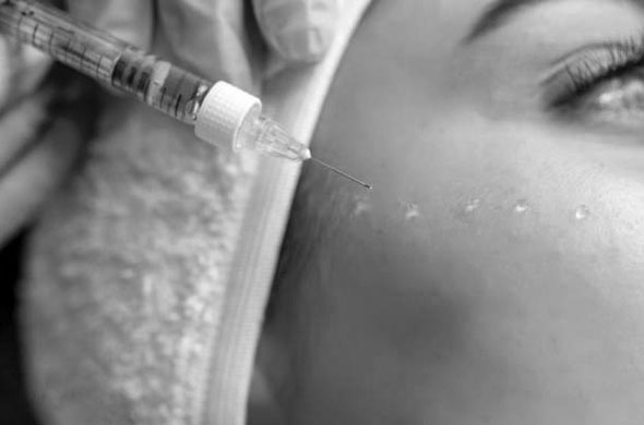 What Is Mesotherapy? Ingredients, Effects, Product Selection & Personalized Treatment Planning